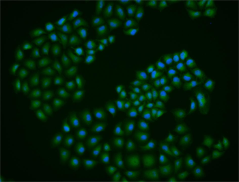 MITF Rabbit Polyclonal Antibody