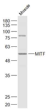 MITF Rabbit Polyclonal Antibody