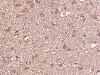 MMP12 Rabbit Polyclonal Antibody