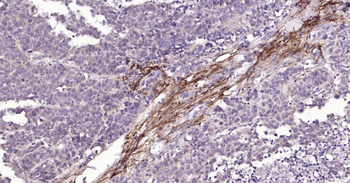 MMP12 Rabbit Polyclonal Antibody