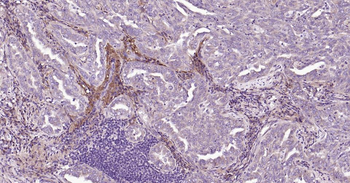 MMP12 Rabbit Polyclonal Antibody