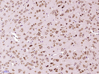 NR3C2/Mineralocorticoid receptor Rabbit Polyclonal Antibody