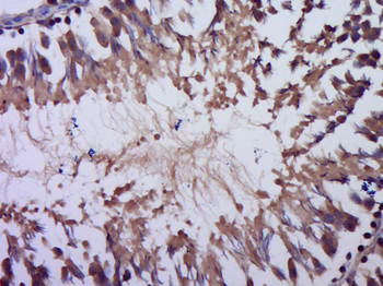 Alpha MSH Rabbit Polyclonal Antibody