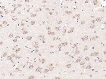 MTOR Rabbit Polyclonal Antibody
