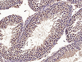 MTOR Rabbit Polyclonal Antibody
