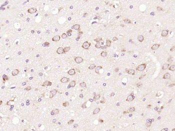 MTOR Rabbit Polyclonal Antibody