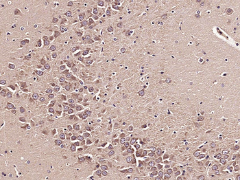 MTOR Rabbit Polyclonal Antibody
