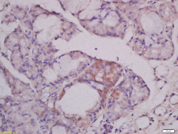 MUC4 Rabbit Polyclonal Antibody