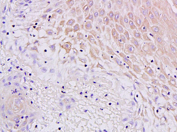 MUC4 Rabbit Polyclonal Antibody