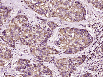FBXO21 Rabbit Polyclonal Antibody