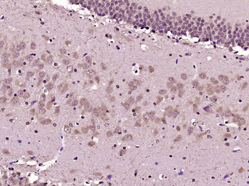 FBXO21 Rabbit Polyclonal Antibody