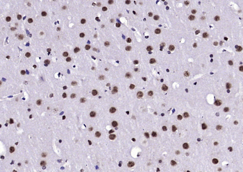 Notch3 Rabbit Polyclonal Antibody