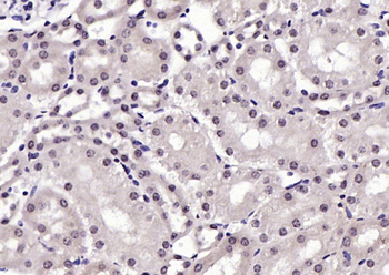 Notch3 Rabbit Polyclonal Antibody