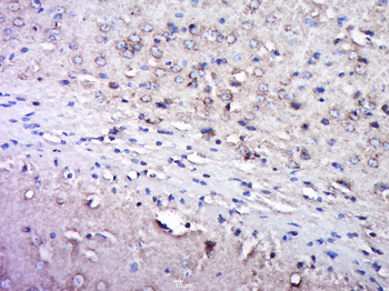 GLUR2 Rabbit Polyclonal Antibody