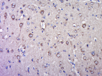 GLUR2 Rabbit Polyclonal Antibody