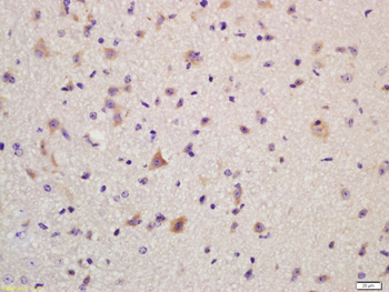 GLUR2 Rabbit Polyclonal Antibody