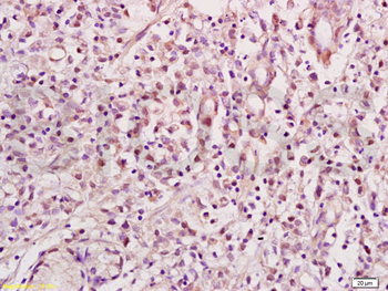 NRSF Rabbit Polyclonal Antibody