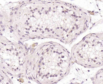 MEK7 Rabbit Polyclonal Antibody