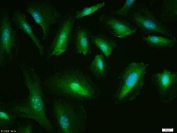 P53 (wt-p53) Rabbit Polyclonal Antibody