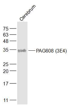 PAG608 (3E4) Mouse Monoclonal Antibody