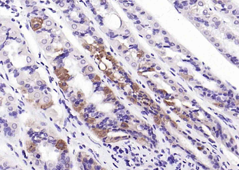 Parkin Rabbit Polyclonal Antibody