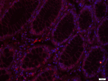 PAX5 Rabbit Polyclonal Antibody