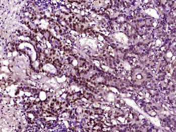 PAX5 Rabbit Polyclonal Antibody