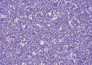 PD-1 Rabbit Polyclonal Antibody