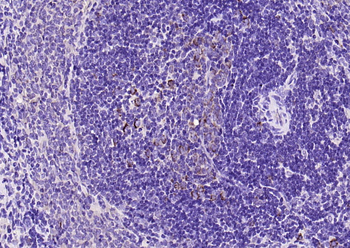 PD-1 Rabbit Polyclonal Antibody