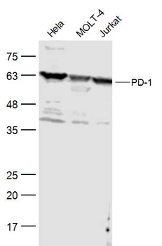 PD-1 Rabbit Polyclonal Antibody