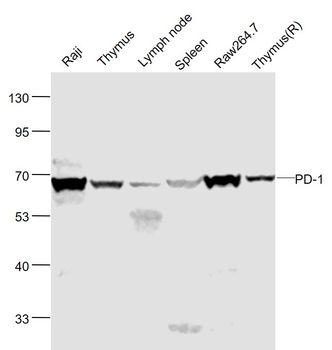 PD-1 Rabbit Polyclonal Antibody