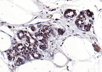 SPDEF Rabbit Polyclonal Antibody