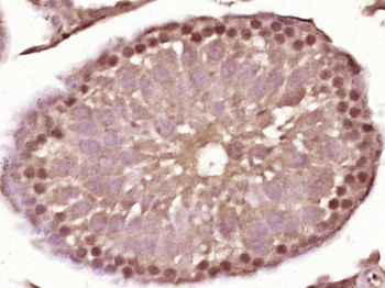 SPDEF Rabbit Polyclonal Antibody