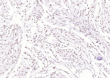 PEG3 Rabbit Polyclonal Antibody