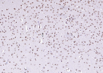 PEG3 Rabbit Polyclonal Antibody