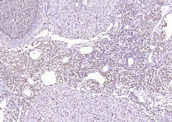 PEG3 Rabbit Polyclonal Antibody