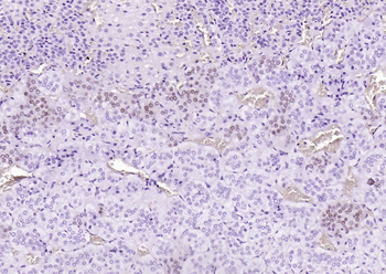 PEG3 Rabbit Polyclonal Antibody