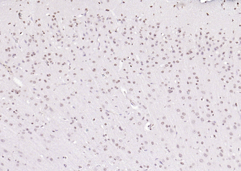 PEG3 Rabbit Polyclonal Antibody