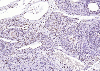 PEG3 Rabbit Polyclonal Antibody