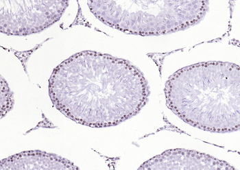 PEG3 Rabbit Polyclonal Antibody