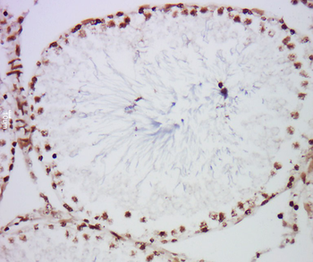 PEG3 Rabbit Polyclonal Antibody