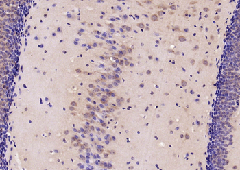 PERK Rabbit Polyclonal Antibody