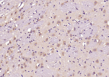 PERK Rabbit Polyclonal Antibody