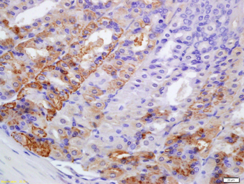 PERK Rabbit Polyclonal Antibody