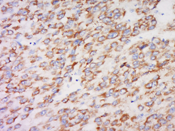 Phospho-PKC beta 1 + PKC beta 2 (Thr500) Rabbit Polyclonal Antibody