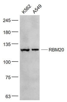 RBM20 Rabbit Polyclonal Antibody