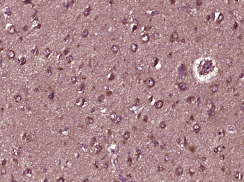 Peroxiredoxin 3 Rabbit Polyclonal Antibody