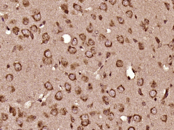 PSAP Rabbit Polyclonal Antibody