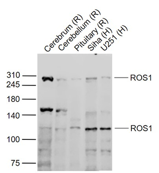 ROS1 Rabbit Polyclonal Antibody