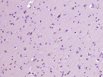 AMD1/SAMDC Rabbit Polyclonal Antibody